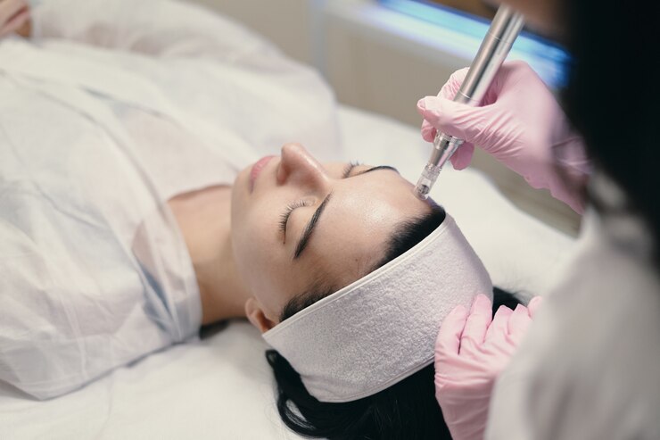 Is Microneedling with PRP Helpful to Reducing Stretch Marks?